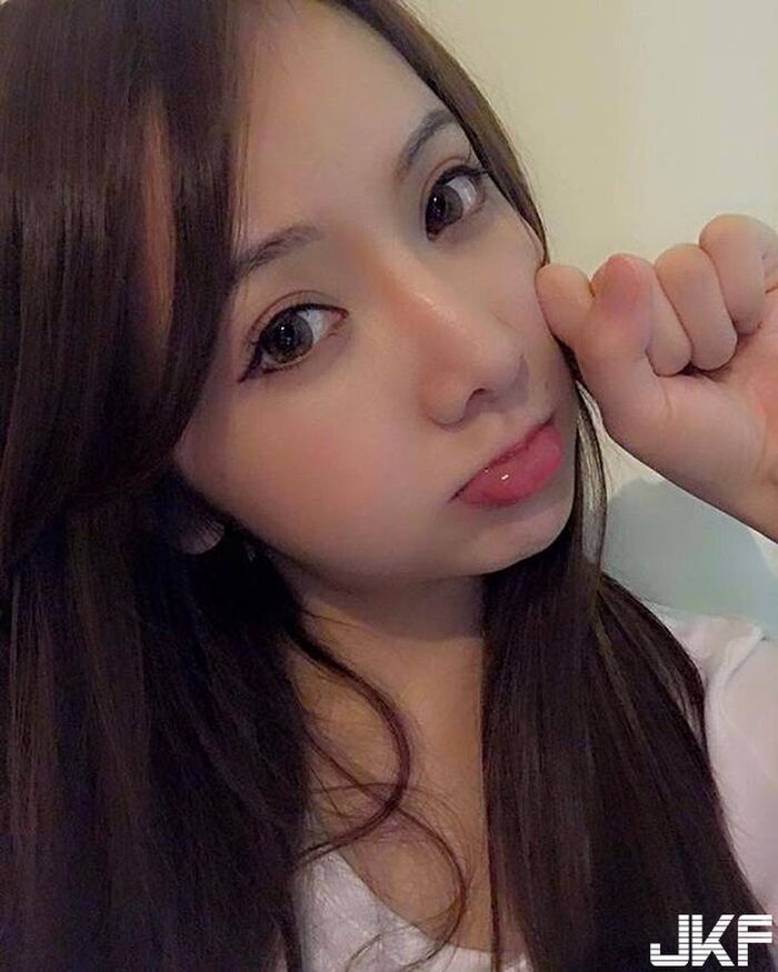 Masaso sister protection 顏 Lee 沒 return 醫 care for my nosebleed and Yingyoke 3th image